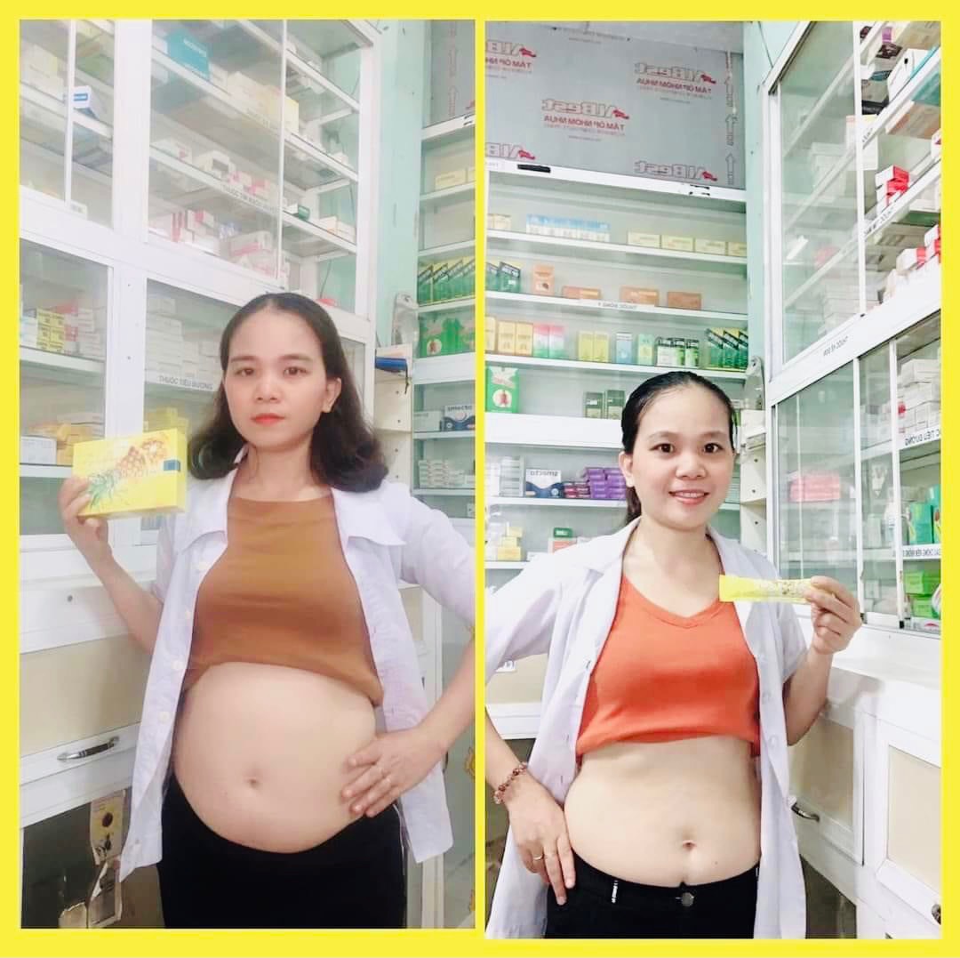 Sản phẩm Thạch dứa giảm cân...