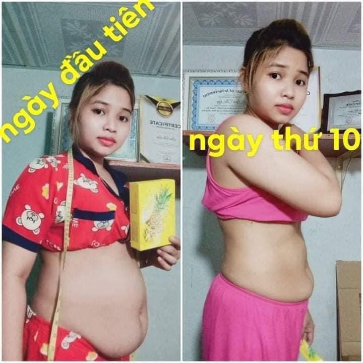 Sản phẩm Thạch dứa giảm cân...