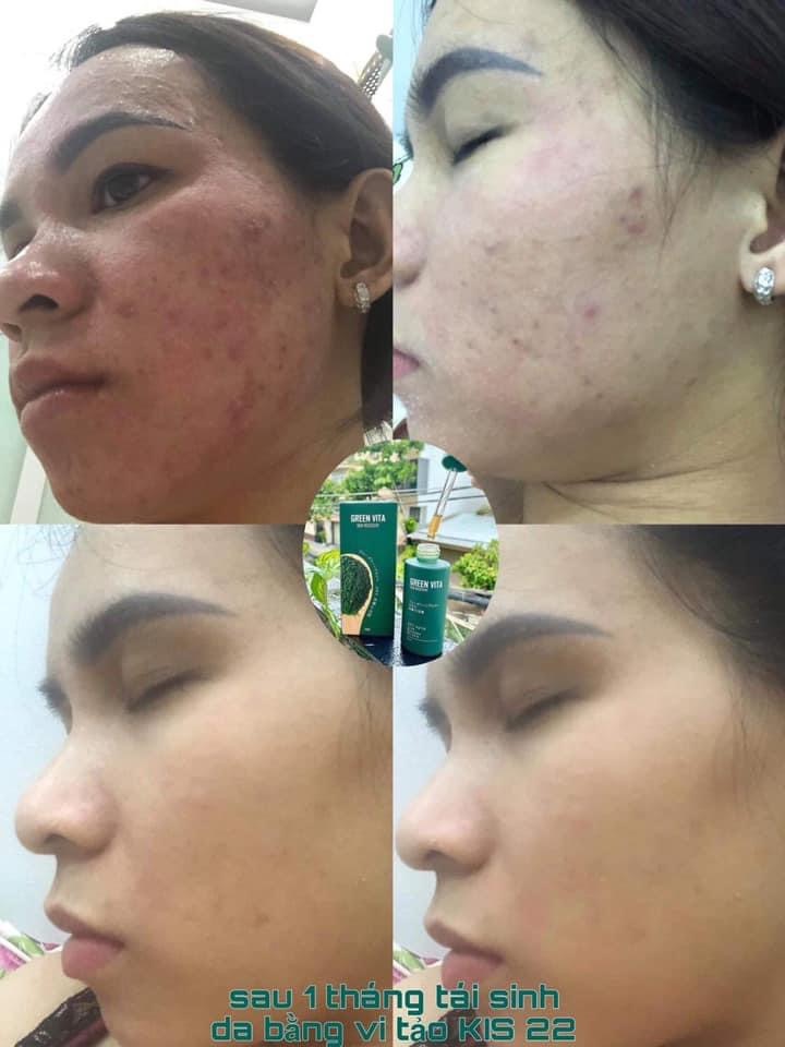 Sản phẩm Thạch dứa giảm cân...