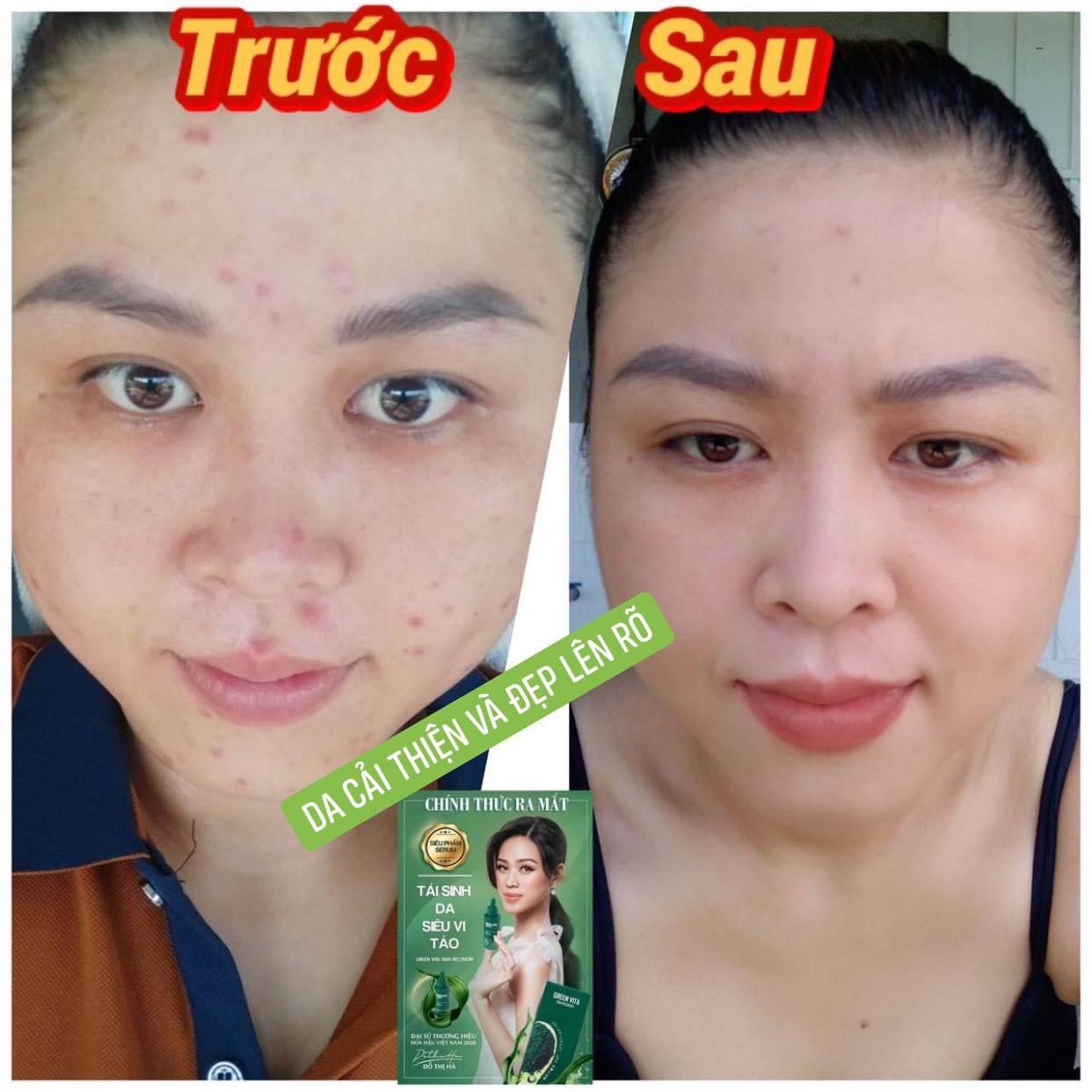 Sản phẩm Thạch dứa giảm cân...