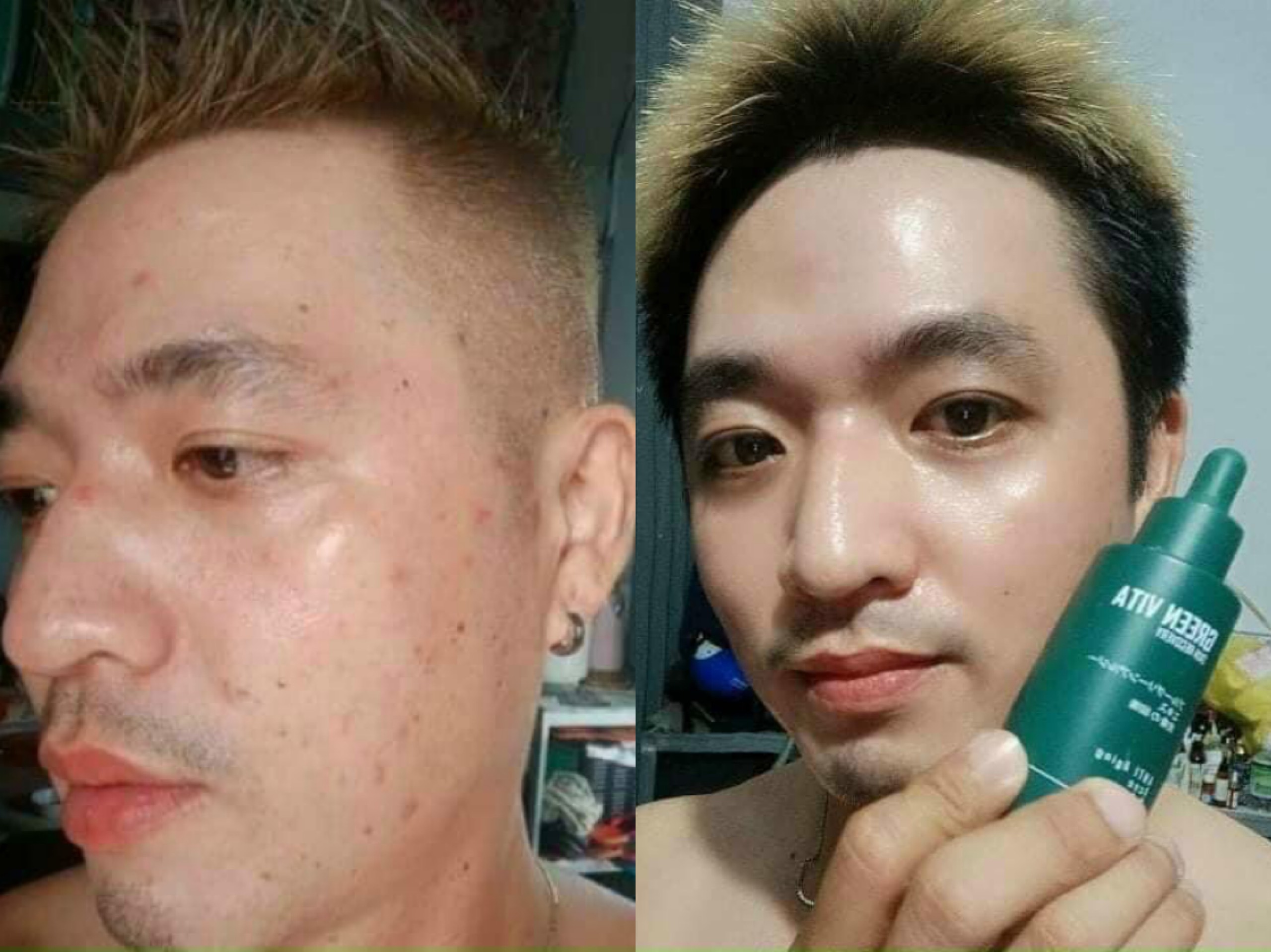 Sản phẩm Thạch dứa giảm cân...