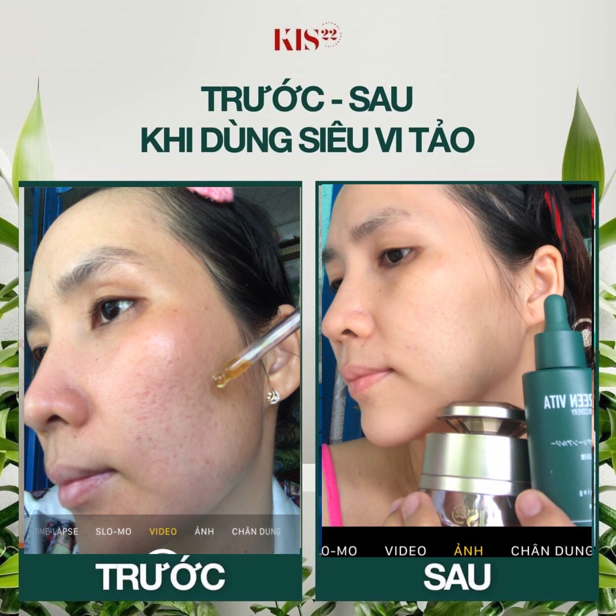 Sản phẩm Thạch dứa giảm cân...