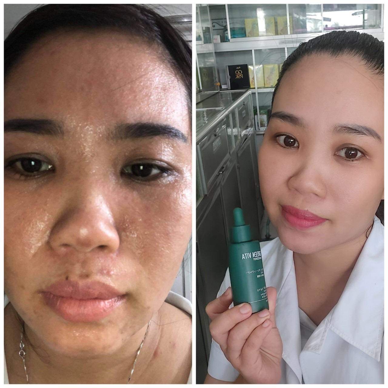 Sản phẩm Thạch dứa giảm cân...