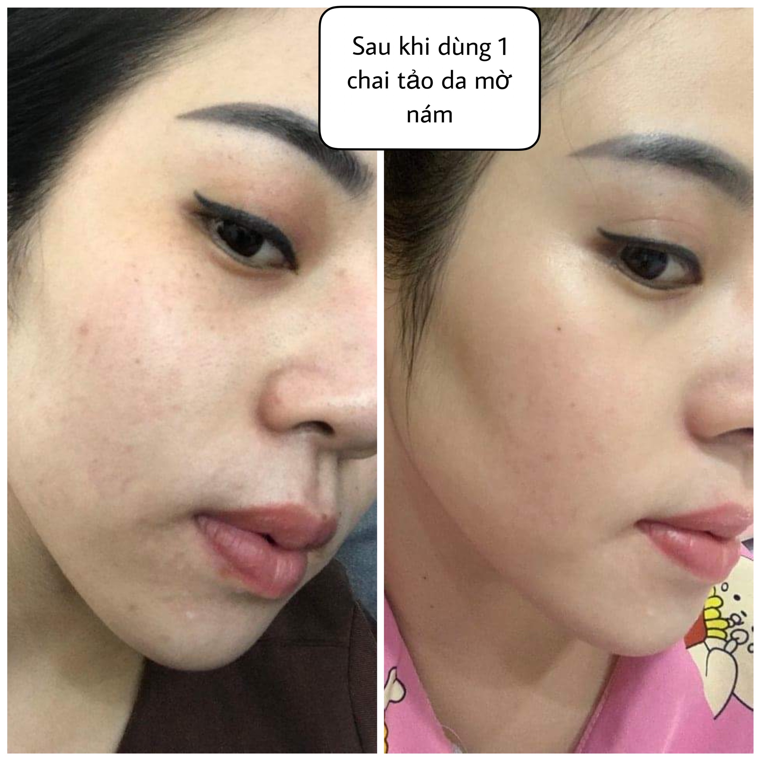 Sản phẩm Thạch dứa giảm cân...